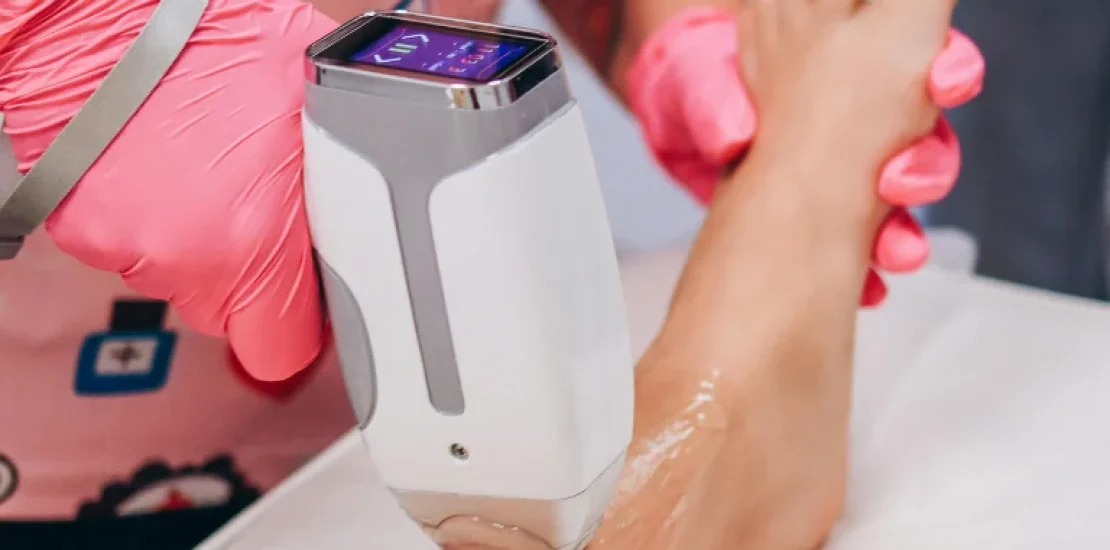 Laser Hair Removal (1)