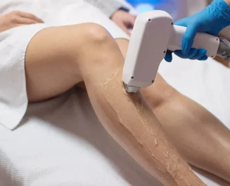 Laser Hair Removal
