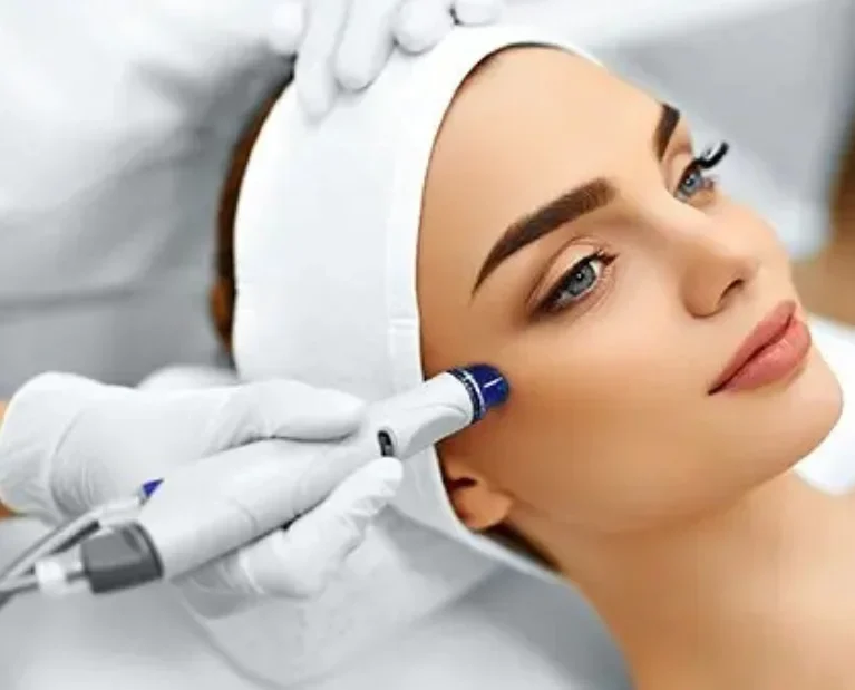 Microdermabrasion (1)